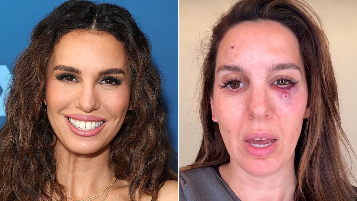 Christy Carlson Romano 'shot in the eye' during clay pigeon shooting outing with her husband for his birthday Internet InfoMedia christy carlson romano shot in the eye during clay pigeon shooting outing with her husband for his birthday