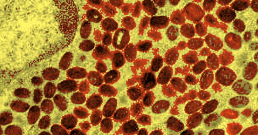 Trump’s W.H.O. Exit Throws Smallpox Defenses Into Upheaval Internet InfoMedia trumps w h o exit throws smallpox defenses into upheaval