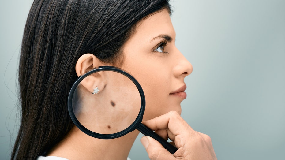 Internet InfoMedia blood test could predict skin cancer recurrence study shows